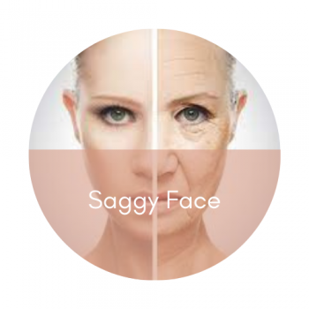 sagging face