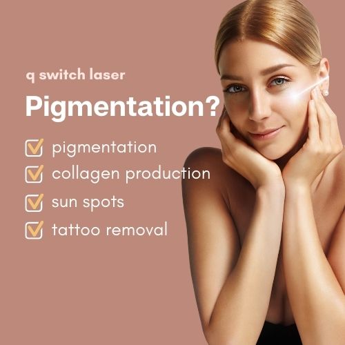 q switch laser pigmentation removal