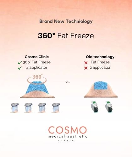 360° fat freeze