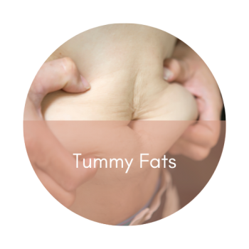 fat freezing tummy fats